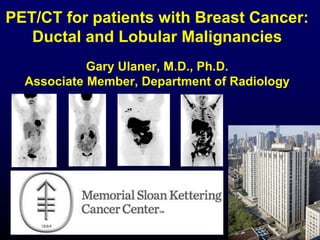 PET/CT for patients with Breast Cancer:
Ductal and Lobular Malignancies
Gary Ulaner, M.D., Ph.D.
Associate Member, Department of Radiology
 