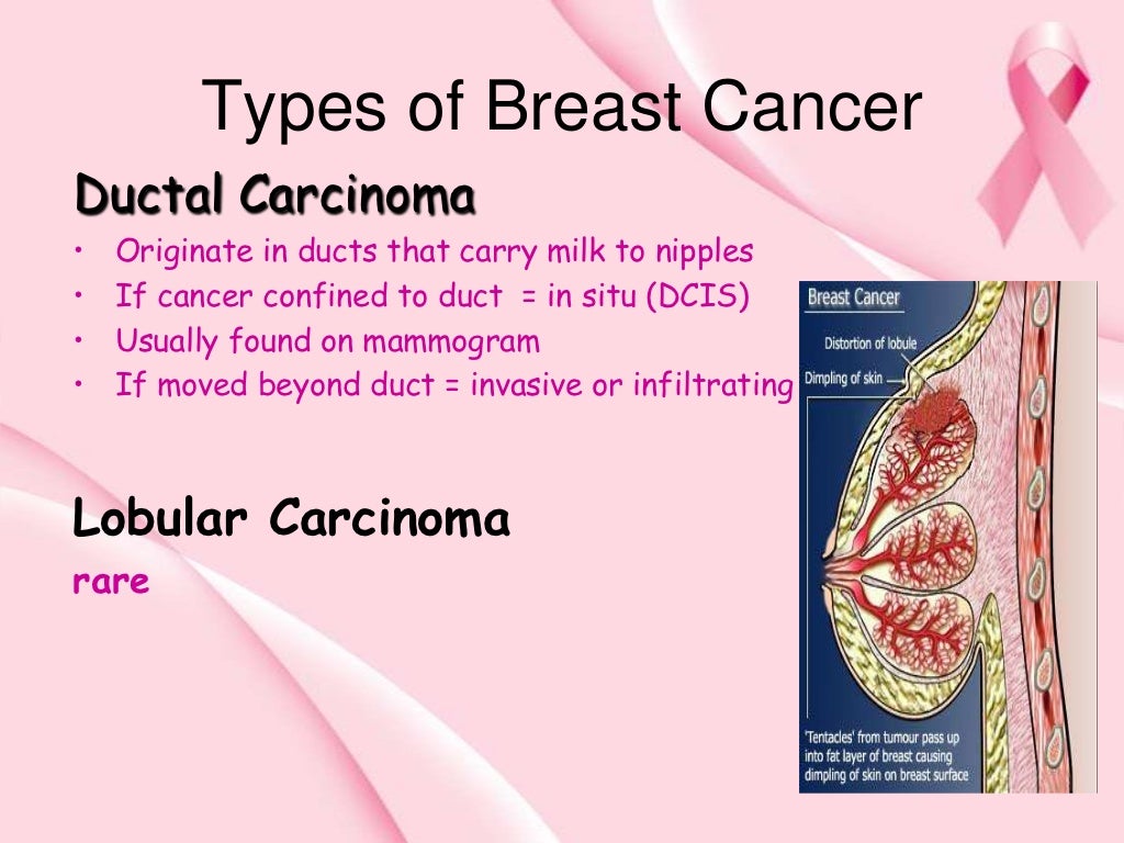 common presentation of breast cancer