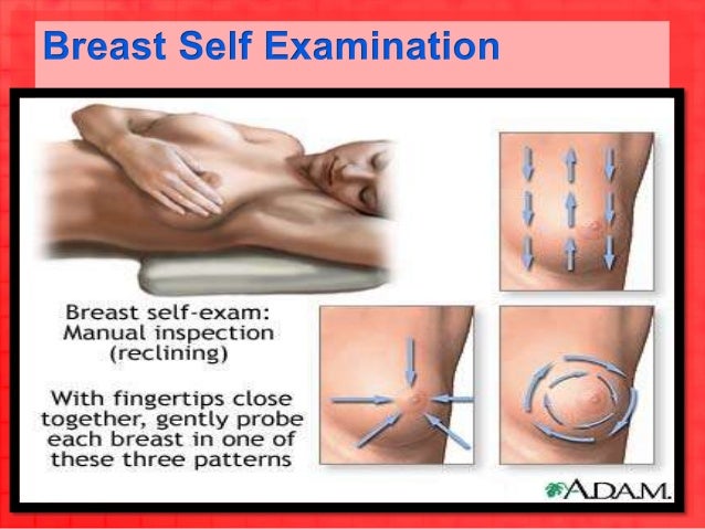 Breast Cancer Ppt - 