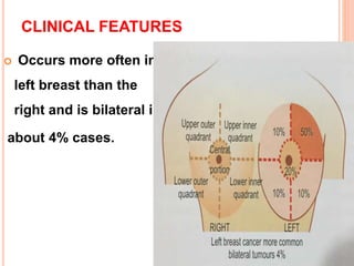 Breast cancer ppt | PPTX