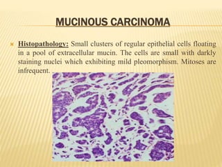MUCINOUS CARCINOMA
 Histopathology: Small clusters of regular epithelial cells floating
in a pool of extracellular mucin. The cells are small with darkly
staining nuclei which exhibiting mild pleomorphism. Mitoses are
infrequent.
 