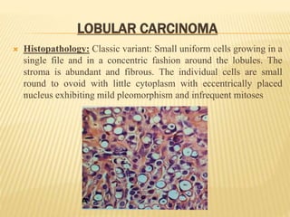 LOBULAR CARCINOMA
 Histopathology: Classic variant: Small uniform cells growing in a
single file and in a concentric fashion around the lobules. The
stroma is abundant and fibrous. The individual cells are small
round to ovoid with little cytoplasm with eccentrically placed
nucleus exhibiting mild pleomorphism and infrequent mitoses
 