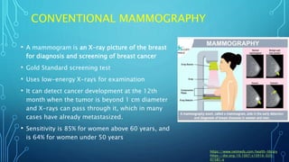 Overview of breast cancer screening and diagnosis | PPTX