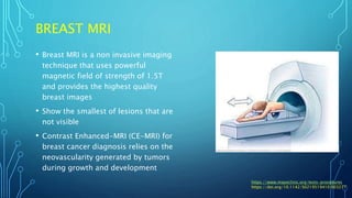 Overview of breast cancer screening and diagnosis | PPTX
