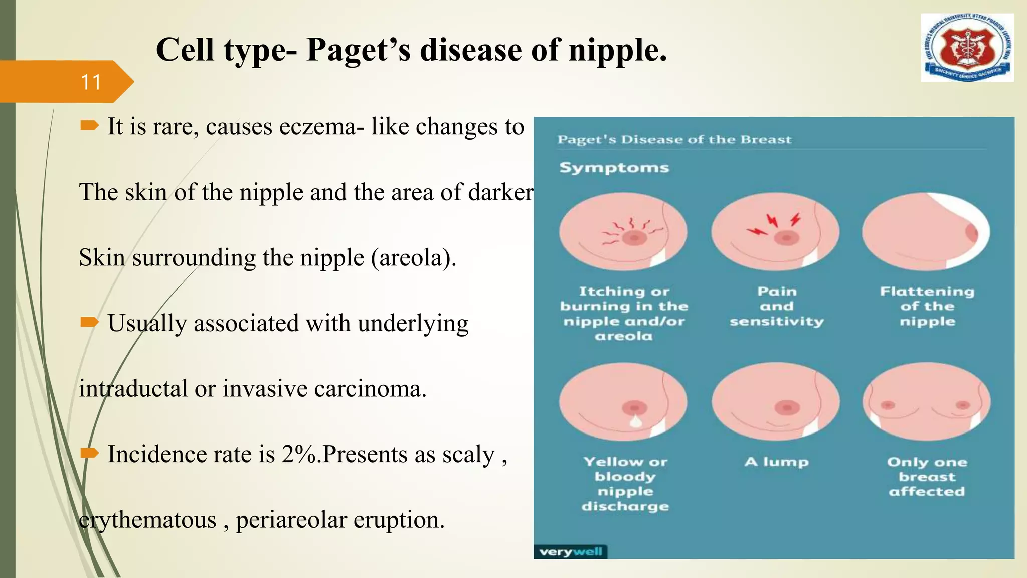 breast cancer ppt.pptx