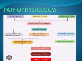 breast cancer ppt (1).pptx
