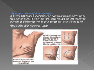 . How often should I do a self-exam?
A breast self-exam is recommended every month a few days after
your period ends. During this time, your breasts are less tender or
swollen. It is important to do your breast self-exam at the same
time during your menstrual cycle.
 