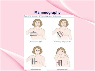 Mammography
 