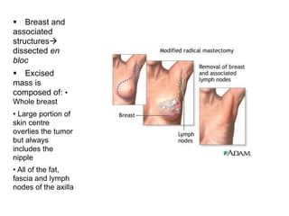" Breast and
associated
structures#
dissected en
bloc
" Excised
mass is
composed of: •
Whole breast
• Large portion of
skin centre
overlies the tumor
but always
includes the
nipple
• All of the fat,
fascia and lymph
nodes of the axilla
 