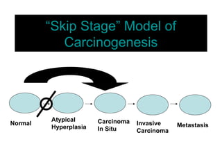 “Skip Stage” Model of
Carcinogenesis
Normal
Atypical
Hyperplasia
Carcinoma
In Situ
Invasive
Carcinoma
Metastasis
 