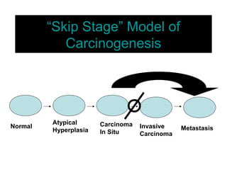 “Skip Stage” Model of
Carcinogenesis
Normal
Atypical
Hyperplasia
Carcinoma
In Situ
Invasive
Carcinoma
Metastasis
 