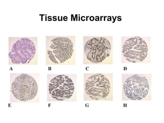 Tissue Microarrays
 