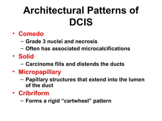 Architectural Patterns of
DCIS
• Comedo
– Grade 3 nuclei and necrosis
– Often has associated microcalcifications
• Solid
– Carcinoma fills and distends the ducts
• Micropapillary
– Papillary structures that extend into the lumen
of the duct
• Cribriform
– Forms a rigid “cartwheel” pattern
 