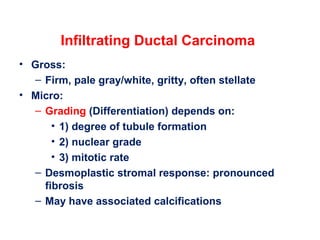 Infiltrating Ductal Carcinoma
• Gross:
– Firm, pale gray/white, gritty, often stellate
• Micro:
– Grading (Differentiation) depends on:
• 1) degree of tubule formation
• 2) nuclear grade
• 3) mitotic rate
– Desmoplastic stromal response: pronounced
fibrosis
– May have associated calcifications
 