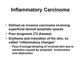 Inflammatory Carcinoma
• Defined as invasive carcinoma involving
superficial dermal lymphatic spaces
• Poor prognosis (T3 disease)
• Erythema and induration of the skin, so
called “inflammatory changes”
– Peau d’orange-dimpling of involved skin due to
retraction caused by lymphatic involvement
and obstruction
 