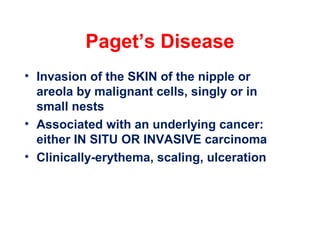Paget’s Disease
• Invasion of the SKIN of the nipple or
areola by malignant cells, singly or in
small nests
• Associated with an underlying cancer:
either IN SITU OR INVASIVE carcinoma
• Clinically-erythema, scaling, ulceration
 