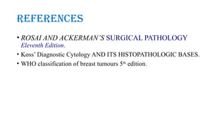 breast carcinoma part various types1.pptx
