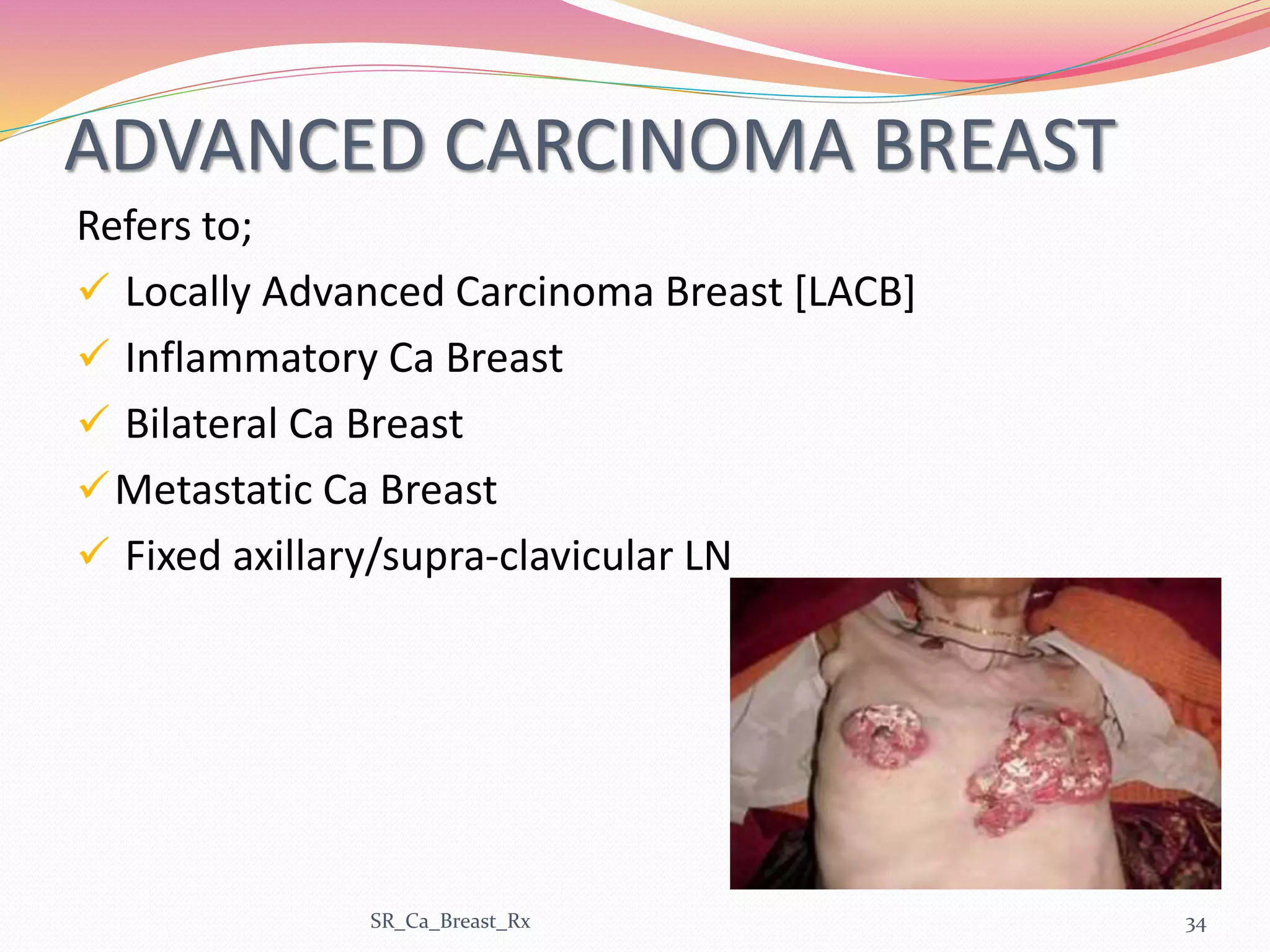 ADVANCED CARCINOMA BREAST
Refers to;
 Locally Advanced Carcinoma Breast [LACB]
 Inflammatory Ca Breast
 Bilateral Ca Breast
Metastatic Ca Breast
 Fixed axillary/supra-clavicular LN
SR_Ca_Breast_Rx 34
 