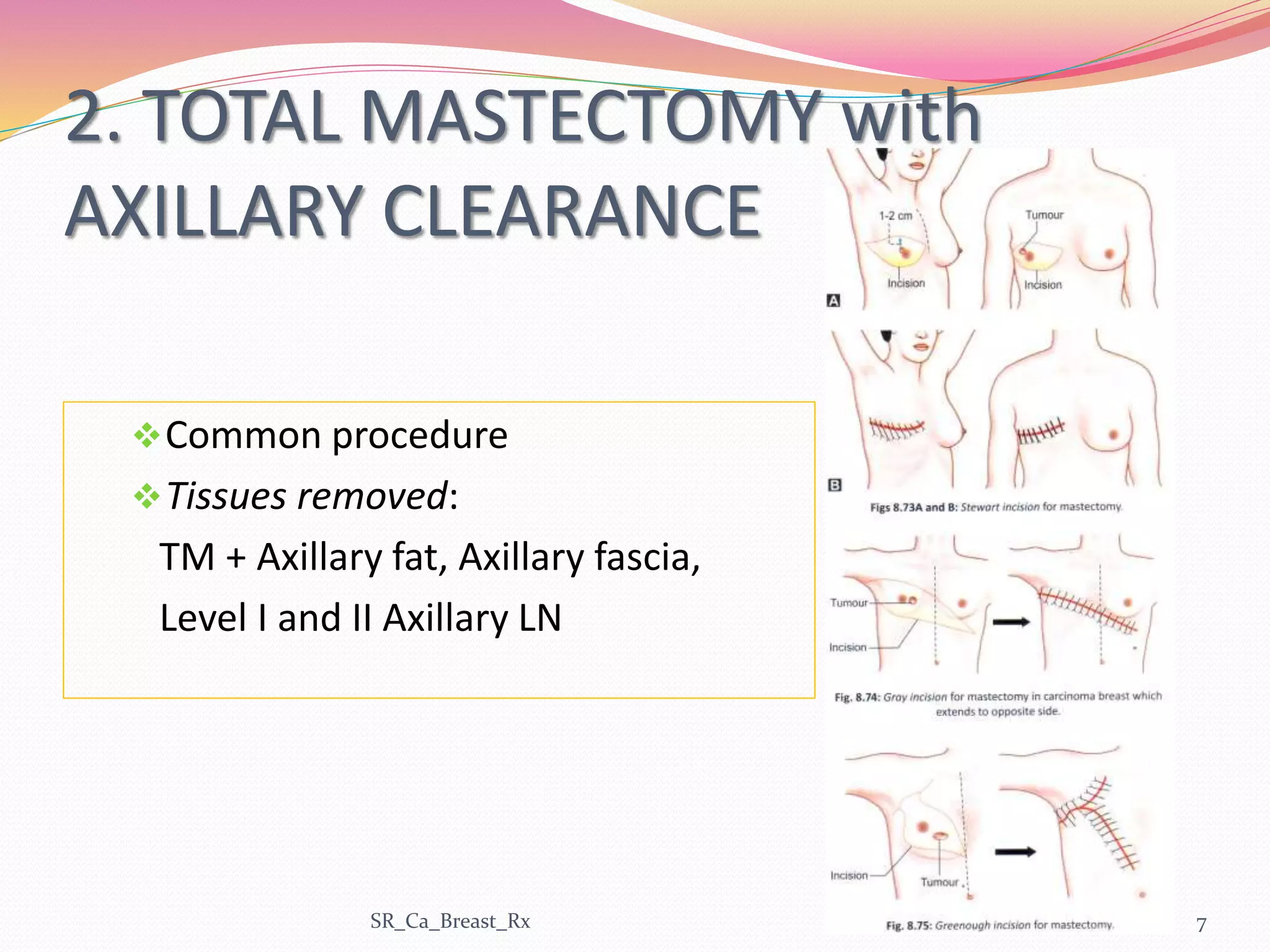 2. TOTAL MASTECTOMY with
AXILLARY CLEARANCE
Common procedure
Tissues removed:
TM + Axillary fat, Axillary fascia,
Level I and II Axillary LN
SR_Ca_Breast_Rx 7
 