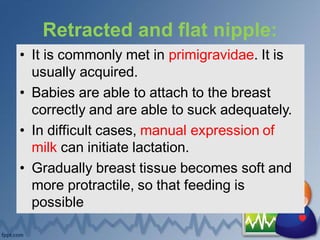 Retracted and flat nipple:
• It is commonly met in primigravidae. It is
usually acquired.
• Babies are able to attach to the breast
correctly and are able to suck adequately.
• In difficult cases, manual expression of
milk can initiate lactation.
• Gradually breast tissue becomes soft and
more protractile, so that feeding is
possible
 