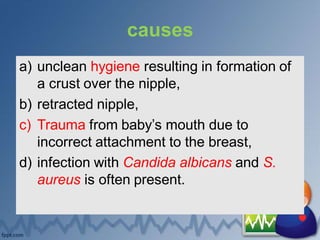 causes
a) unclean hygiene resulting in formation of
a crust over the nipple,
b) retracted nipple,
c) Trauma from baby’s mouth due to
incorrect attachment to the breast,
d) infection with Candida albicans and S.
aureus is often present.
 