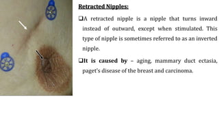 BREAST COMPLICATIONS.pptx