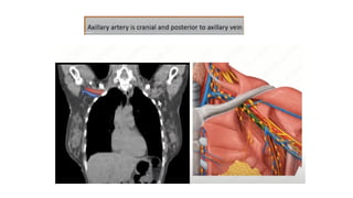 target delineation for breast and axillary nodes contouring.pptx
