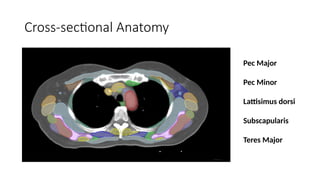 target delineation for breast and axillary nodes contouring.pptx