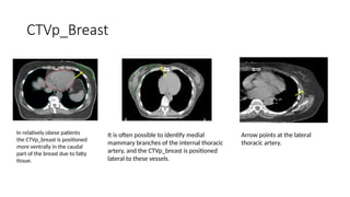 target delineation for breast and axillary nodes contouring.pptx