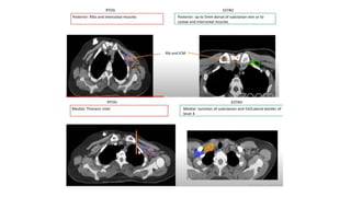 target delineation for breast and axillary nodes contouring.pptx