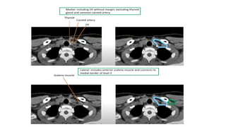 target delineation for breast and axillary nodes contouring.pptx