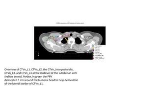 target delineation for breast and axillary nodes contouring.pptx