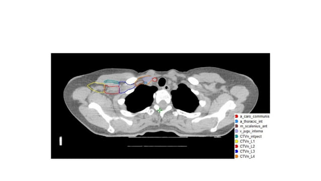 target delineation for breast and axillary nodes contouring.pptx