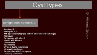 Breast cyst imaging