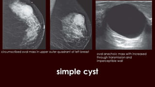 Breast cyst imaging