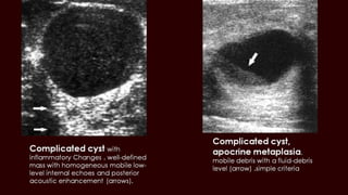 Breast cyst imaging