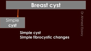 Breast cyst imaging
