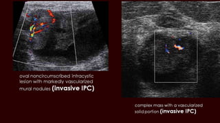 Breast cyst imaging
