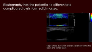Breast cyst imaging