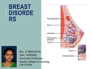 Breast disorders