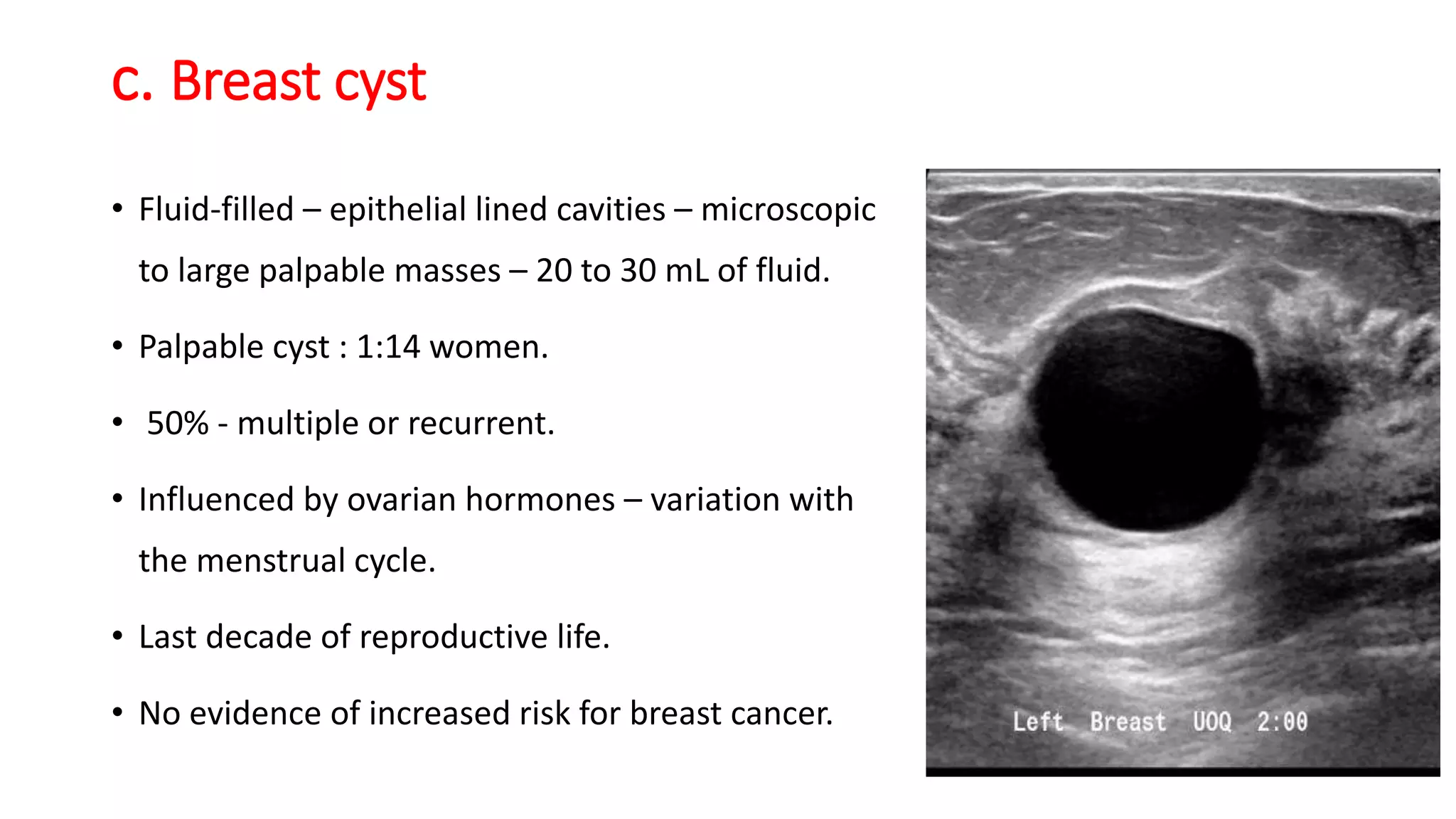 Breast disorders | PPTX