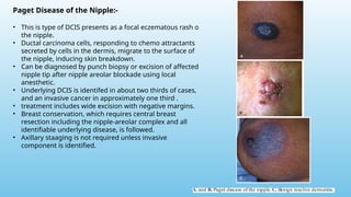 Comprehensive Overview of Breast Diseases: Diagnosis and Management | PPTX