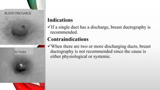 Breast Ductography.pptx
