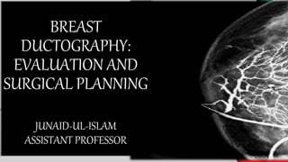 BREAST
DUCTOGRAPHY:
EVALUATION AND
SURGICAL PLANNING
JUNAID-UL-ISLAM
ASSISTANT PROFESSOR
 