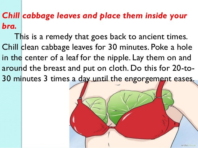 Breastengorgement 130621100349 Phpapp02