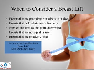If the Bra Fits: The Accepted and Not Offensive Term is Pendulous