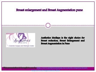 Aesthetics Medispa is the right choice for
Breast reduction, Breast Enlargement and
Breast Augmentation in Pune
Breast enlargement and Breast Augmentation pune
This presentation is brought to you by http://www.aestheticsmedispa.in/cosmetic-surgeries/breast-
surgery/breast-augmentation.html
 