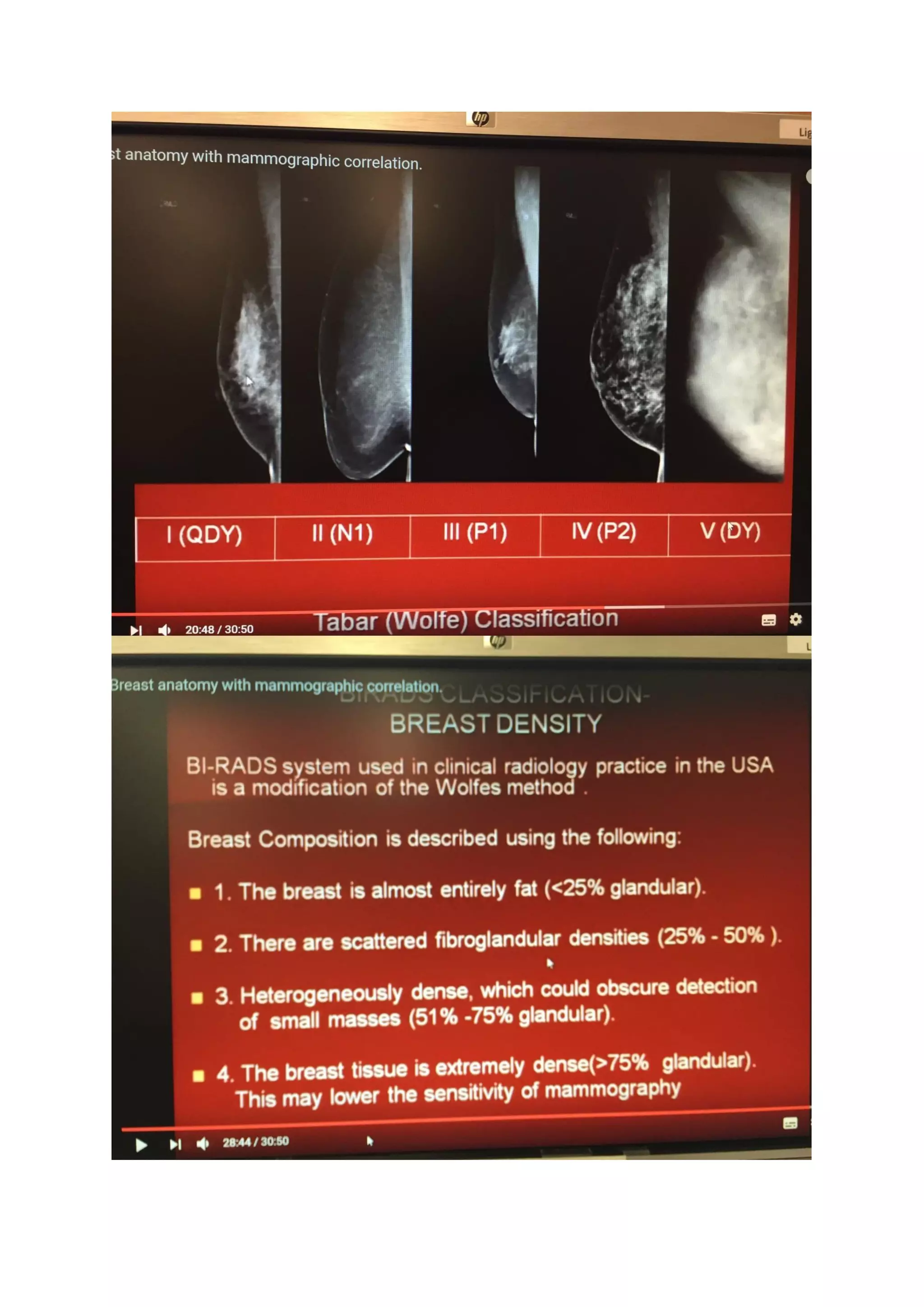 Breast Esoteric Topics | PDF