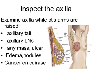 Clinical Examination of Breast | PPTX