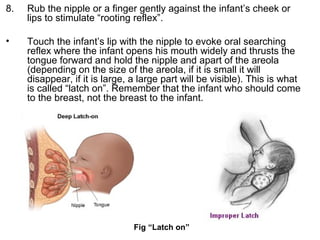 8. Rub the nipple or a finger gently against the infant’s cheek or
lips to stimulate “rooting reflex”.
• Touch the infant’s lip with the nipple to evoke oral searching
reflex where the infant opens his mouth widely and thrusts the
tongue forward and hold the nipple and apart of the areola
(depending on the size of the areola, if it is small it will
disappear, if it is large, a large part will be visible). This is what
is called “latch on”. Remember that the infant who should come
to the breast, not the breast to the infant.
Fig “Latch on”
 